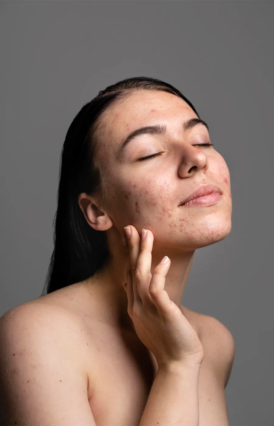 Uống Nước Cần Tây Làm Đẹp Nhưng Nổi Mụn: Đừng Lo Lắng!